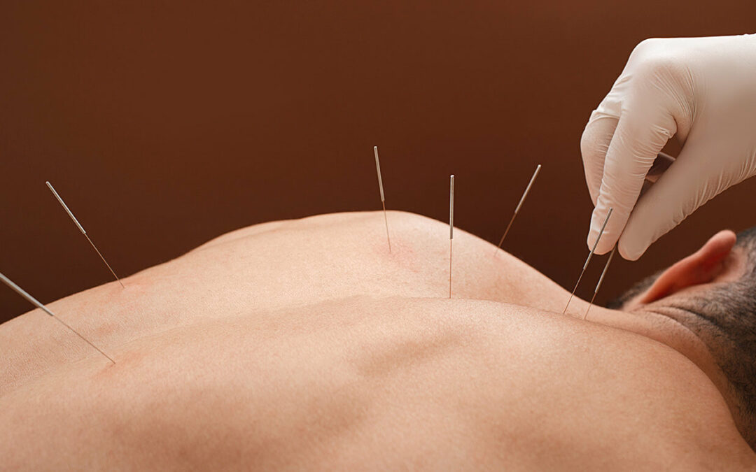The Simple Healing Power of the Needle